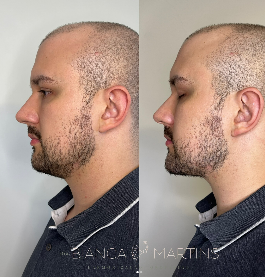 preenchimento masculino