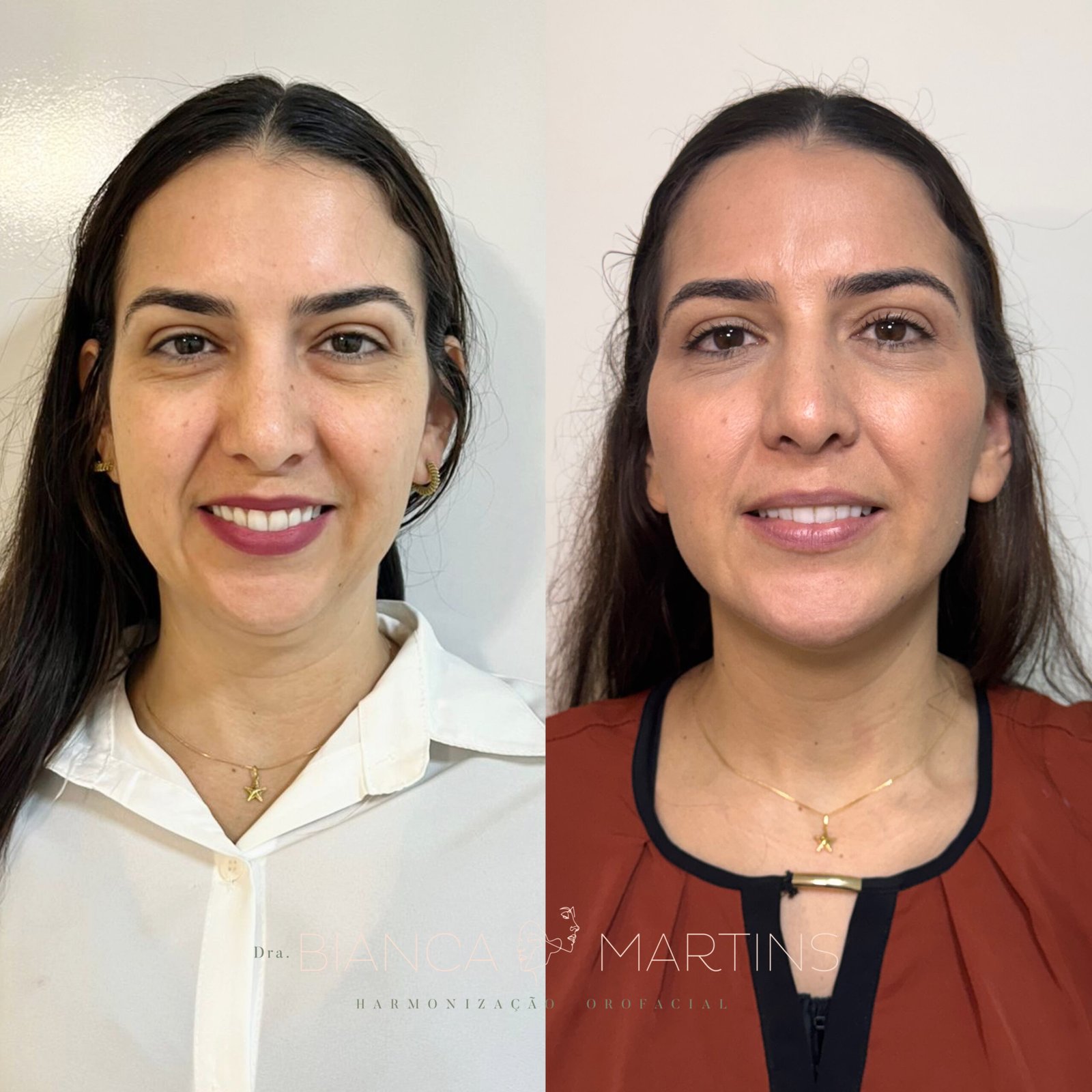 38E9D261-1E96-478D-86B4-F230DD08A07D