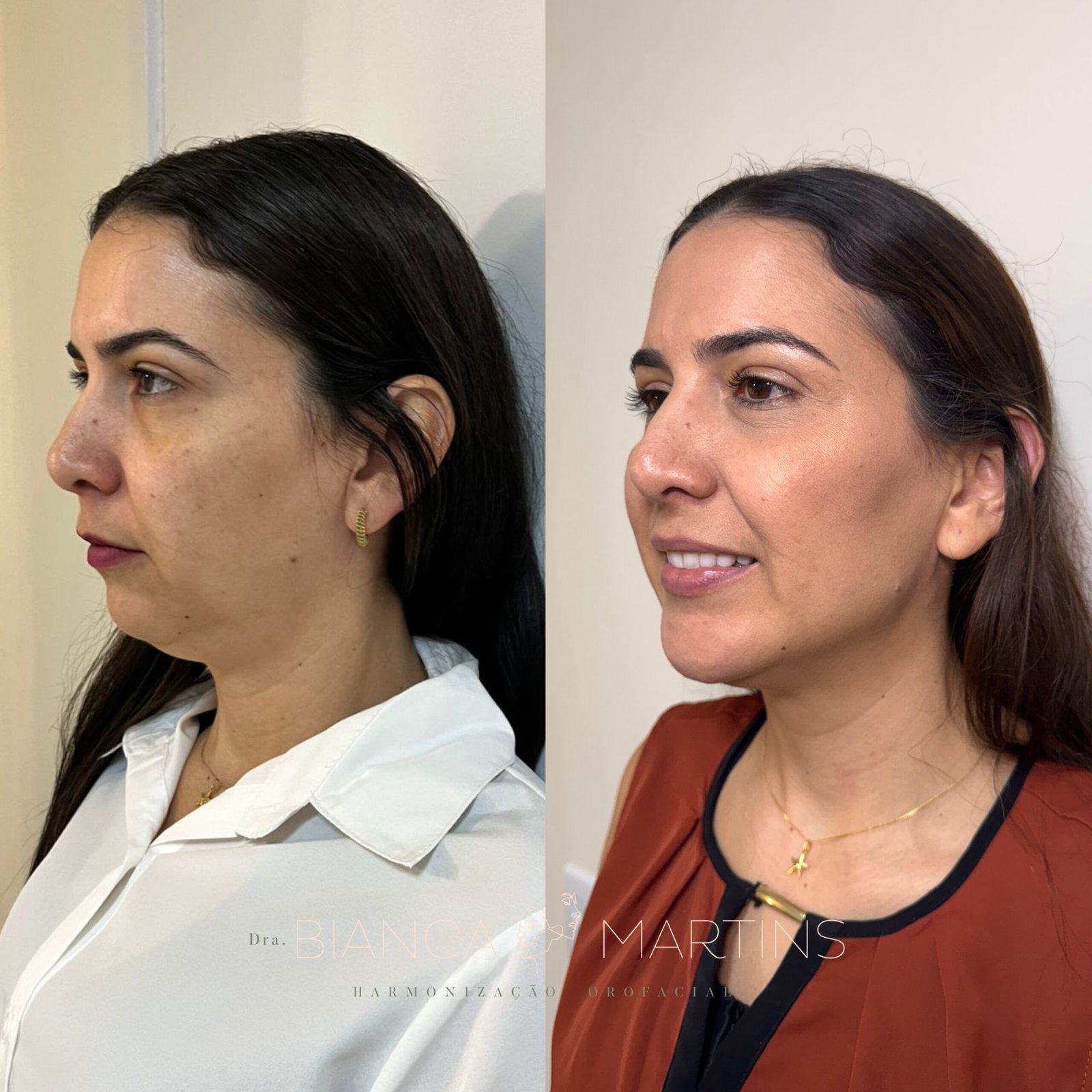 FE3A3B72-557A-419B-9088-0268125DA6A5